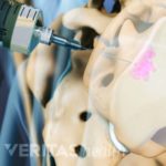 The Value of Medical History and Physical Examination in Diagnosing Sacroiliac Joint Pain.