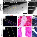 Fibrin Injection Stimulates Early Disc Healing in the Porcine Model