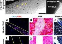 Fibrin Injection Stimulates Early Disc Healing in the Porcine Model